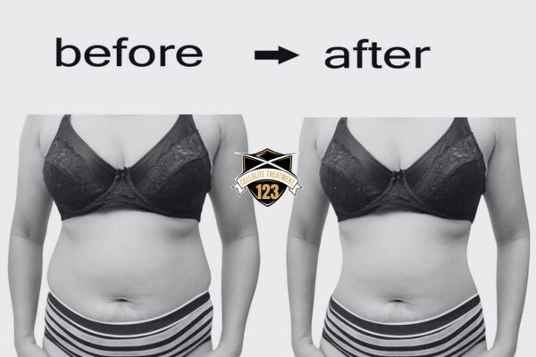 Fat Reduction and Toning treatment for stomach